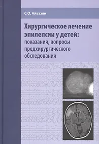 Купить Хирургическое лечение эпилепсии у детей: показания, вопросы предхирургического обследования — Фото №1