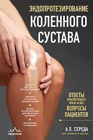 Купить Эндопротезирование коленного сустава: ответы практикующего врача на все вопросы пациентов — Фото №1