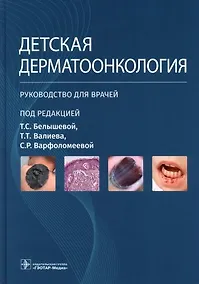Купить Детская дерматоонкология. Руководство для врачей — Фото №1
