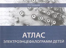 Купить Атлас электроэнцефалограмм детей — Фото №1