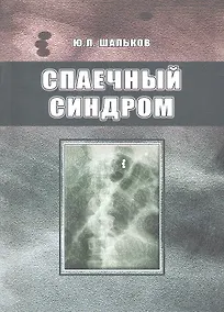 Купить Спаечный синдром. — Фото №1