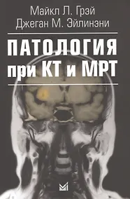 Купить Патология при КТ и МРТ — Фото №1