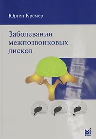 Купить Заболевания межпозвонковых дисков — Фото №1
