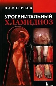 Купить Урогенитальный хламидиоз — Фото №1