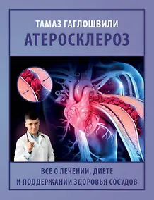 Купить Атеросклероз. Все о лечении, диете и поддержании здоровья сосудов — Фото №1