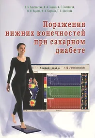Купить Поражения нижних конечностей при сахарном диабете — Фото №1