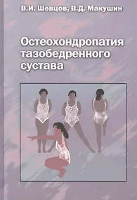 Купить Остеохондропатия тазобедренного сустава. Руководство для врачей — Фото №1