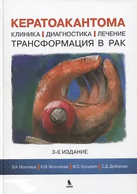 Купить Кератоакантома. Клиника, диагностика, лечение, трансформация в рак. 3-е издание — Фото №1