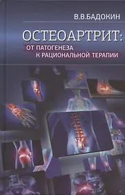 Купить Остеоартрит: от патогенеза к рациональной терапии — Фото №1