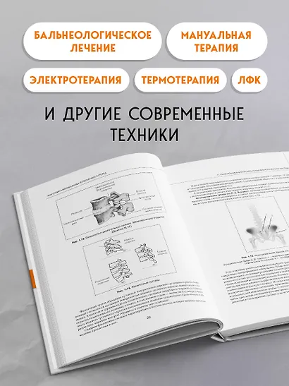 Остеохондроз позвоночника. Методики немедикаментозного лечения болей в спине - фото 5