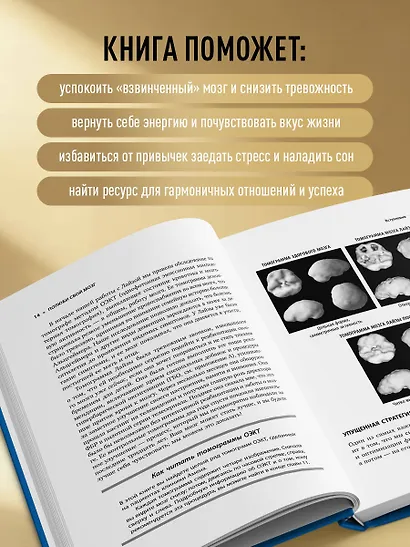 Полюби свой мозг. Быстрый способ преодолеть тревогу, стресс, гнев и начать полноценно жить - фото 5