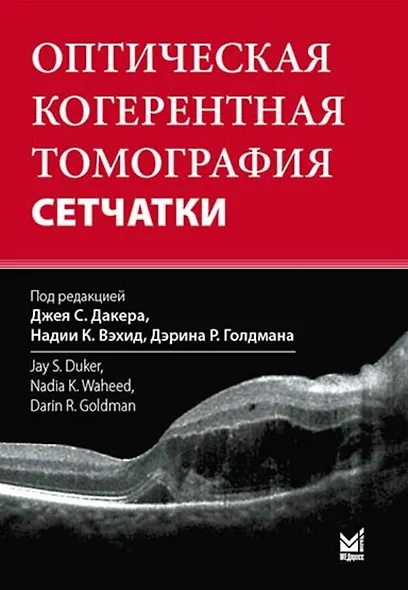 Оптическая когерентная томография сетчатки - фото 2