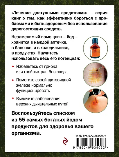 Йод лечит: ожоги и раны, атеросклероз, варикоз, ОРВИ и ОРЗ - фото 2