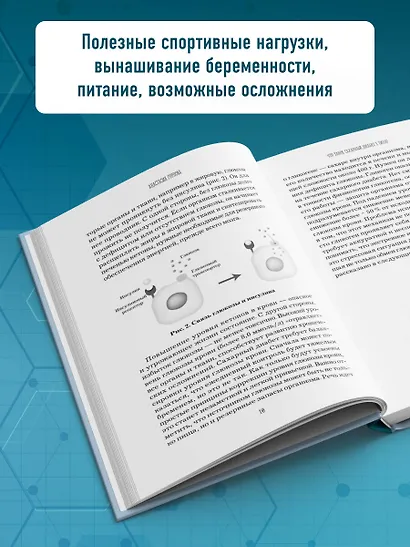 Сахарный диабет I типа. Как держать глюкозу под контролем и избежать развития осложнений заболевания - фото 6
