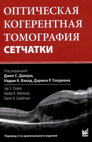 Оптическая когерентная томография сетчатки. Перевод 2-го оригинального издания - фото 1