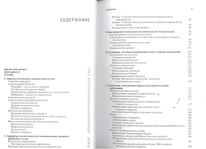 Грамматика артрита. - фото 2