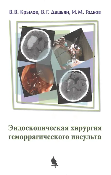 Эндоскопическая хирургия геморрагического инсульта - фото 1