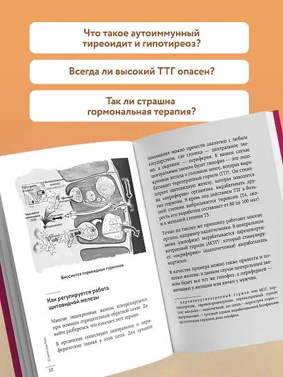 Страсти по щитовидке. Аутоиммунный тиреоидит, гипотиреоз: почему иммунитет работает против нас? - фото 6