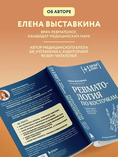 Ревматология по косточкам. Симптомы, диагнозы, лечение - фото 8