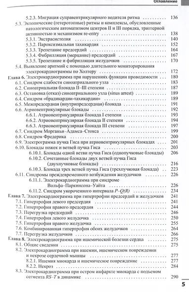 Электрокардиография - фото 4