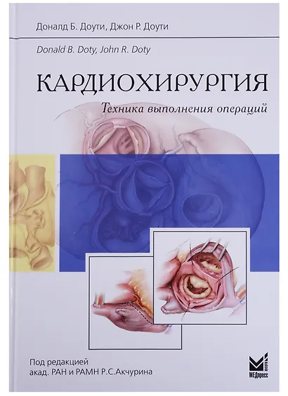 Кардиохирургия.Техника выполнения операций - фото 1