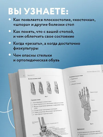 Стопы без боли. Все о плоскостопии, косточках и не только - фото 5