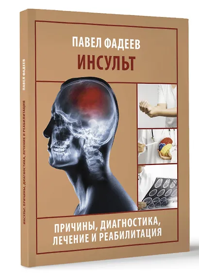 Инсульт. Причины, диагностика, лечение и реабилитация - фото 3