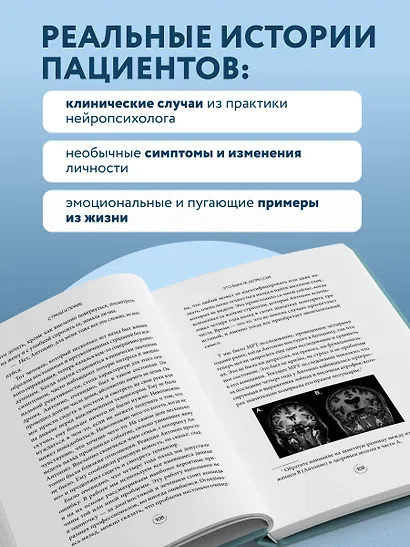 Хрупкий разум. Нейропсихолог о том, какие сбои происходят в мозге и как это меняет личность человека - фото 9