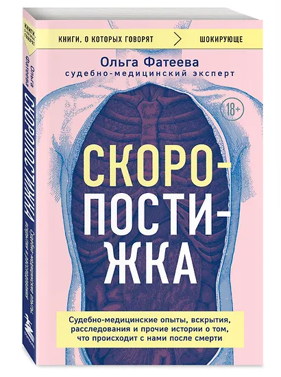 Скоропостижка. Судебно-медицинские опыты, вскрытия, расследования и прочие истории о том, что происходит с нами после смерти - фото 3