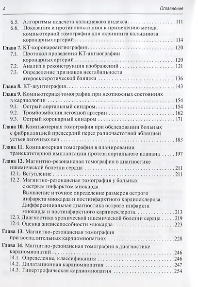 Томография сердца - фото 3