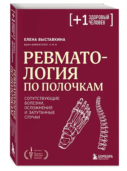 Ревматология по полочкам. Сопутствующие болезни, осложнения и запутанные случаи - фото 3