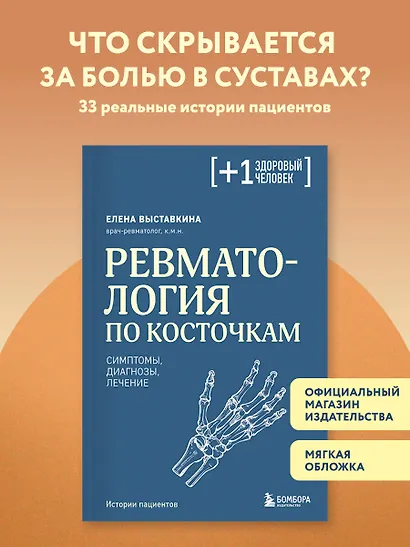Ревматология по косточкам. Симптомы, диагнозы, лечение - фото 4