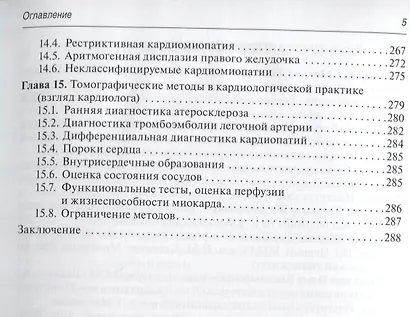 Томография сердца - фото 4