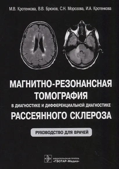 Магнитно-резонансная томография в диагностике и дифференциальной диагностике рассеянного склероза. Руководство для врачей - фото 1