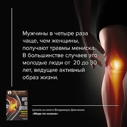 Море по колено. Самодиагностика и лечение боли в коленном суставе - фото 6