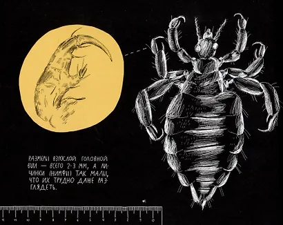 Почему голова чешется? - фото 4