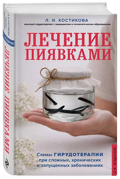 Лечение пиявками. Схемы гирудотерапии при сложных, хронических и запущенных заболеваниях - фото 3