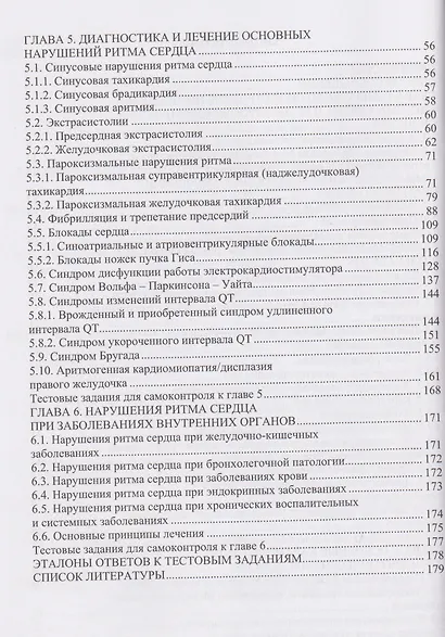 Нарушения ритма сердца: диагностические подходы и терапия - фото 3