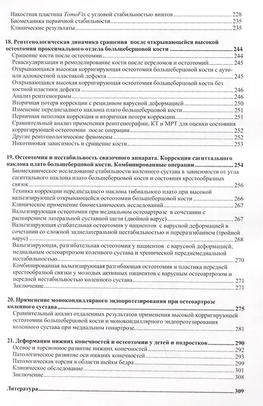Остеотомии в области коленного сустава - фото 4