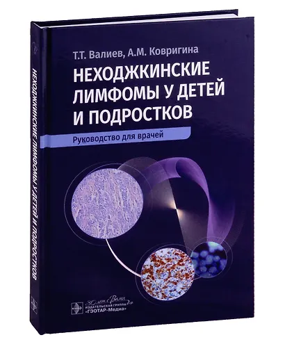 Неходжкинские лимфомы у детей и подростков: руководство для врачей - фото 1