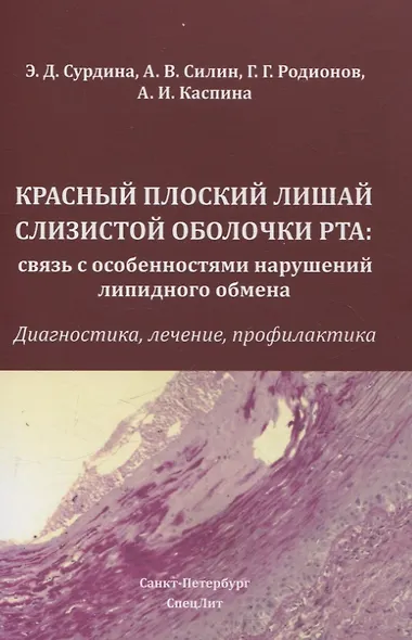 Красный плоский лишай слизистой оболочки рта: связь с особенностями нарушений липидного обмена - фото 1
