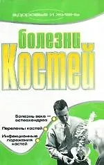 Болезни костей - фото 1