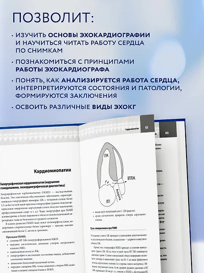 Эхокардиография для начинающих. Суть гемодинамических нарушений, позиции для анализа, определение тяжести порока. 2-е издание, исправленное и дополненное - фото 5
