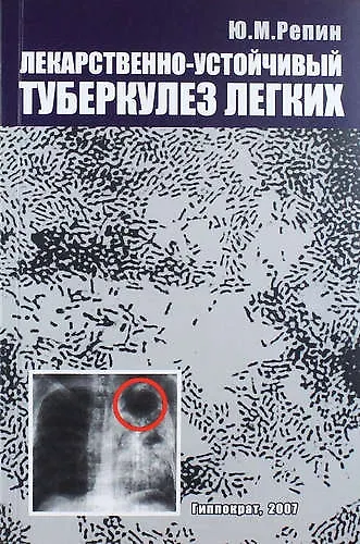 Лекарственно-устойчивый туберкулез легких: хирургическое лечение - фото 1