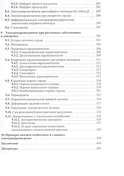 Руководство по практической электрокардиографии - фото 5
