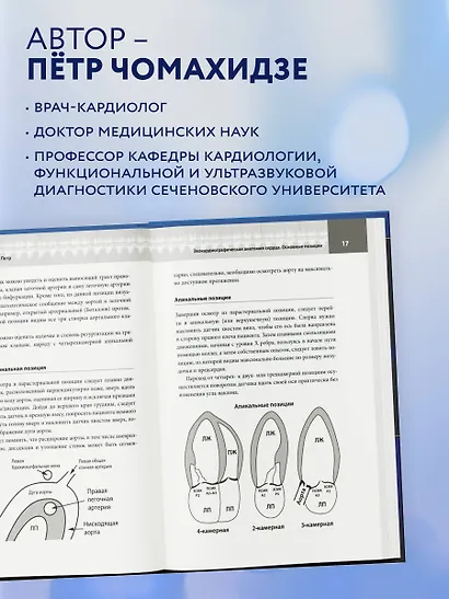 Эхокардиография для начинающих. Суть гемодинамических нарушений, позиции для анализа, определение тяжести порока. 2-е издание, исправленное и дополненное - фото 8