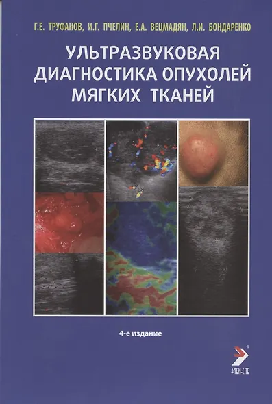 Ультразвуковая диагностика опухолей мягких тканей - фото 4