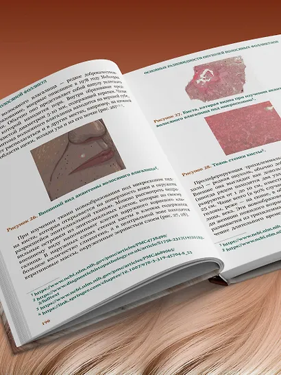 Волосы. Иллюстрированное пособие для врачей, трихологов и парикмахеров - фото 10