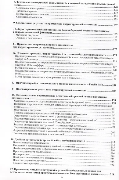 Остеотомии в области коленного сустава - фото 3