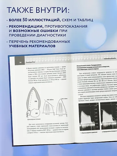 Эхокардиография для начинающих. Суть гемодинамических нарушений, позиции для анализа, определение тяжести порока. 2-е издание, исправленное и дополненное - фото 6
